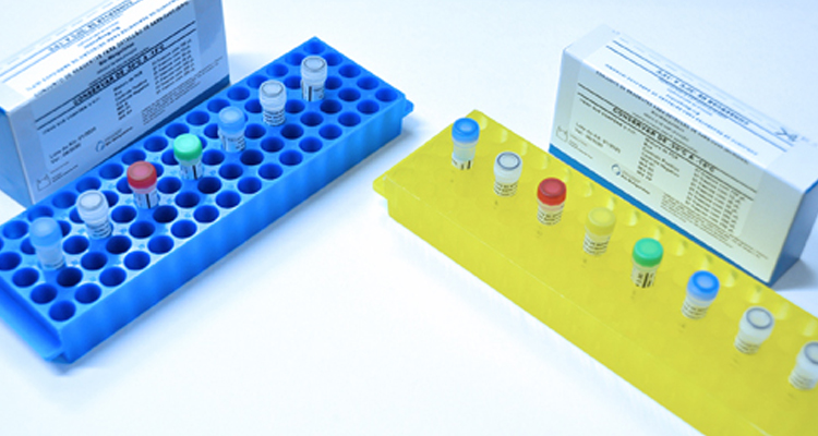 No RN, Ministério da Saúde distribui 68,8 mil testes de sorologia e 61,1 mil de biologia molecular para Covid-19